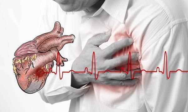 人体发生"心梗"前,身体试图给出4个"暗示",你却无视了|心肌梗塞|心