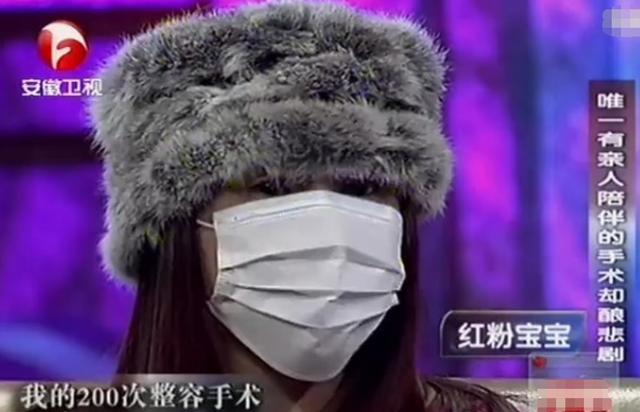整容200多次,花费400多万的"红粉宝宝",如今变成什么样了?