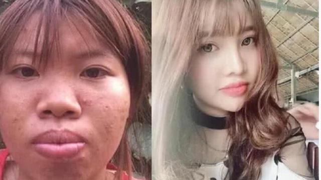 当年为嫁入豪门,不惜花十万整容的越南丑女