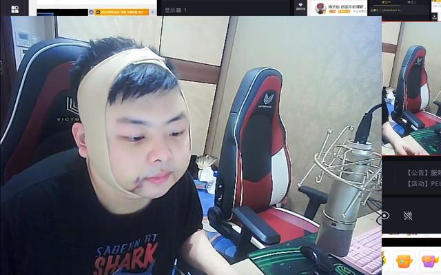 lol西卡做痔疮手术意外破相回应抽脂质疑1辈子不会公开手术