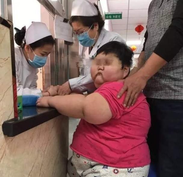 3岁男童体重150斤,背后隐藏的儿童肥胖问题,值得家长重视起来