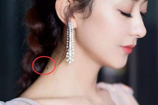 发财痣,身体4个部位长吉痣,收入多,有钱花