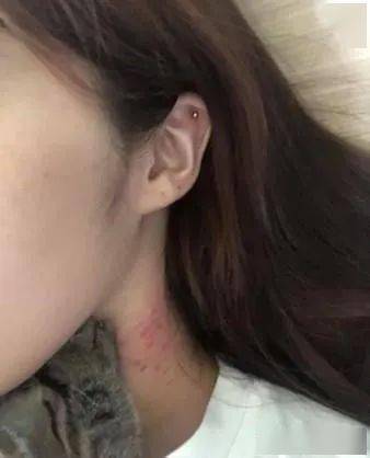 小猫看到肉肉就开吸结果她的脖子被种满草莓