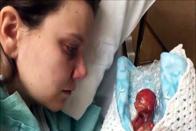 14年前那个史上最小婴儿,把蛋壳当"摇篮",现在过得怎么样呢