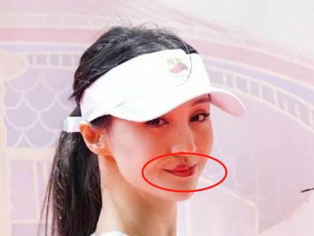 脸有些奇怪,特别是嘴角的位置,除了早年的烫伤外,还突出了一大块红唇