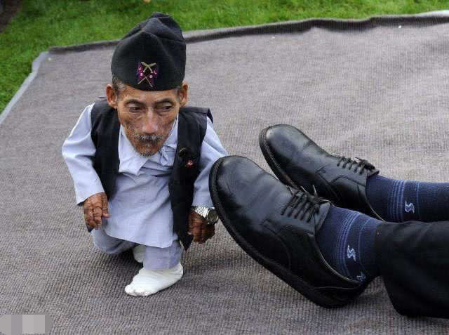 世界上"最小"的嘴,获得吉尼斯纪录认证,吃饼干都费劲!