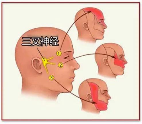 即对面部给予极轻微的刺激可诱发极为剧烈的疼痛发作;③三叉神经