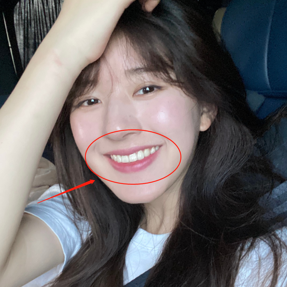赵露思淡妆微笑自拍,无意间露出牙齿那一刻,这颜色我没眼花吧?