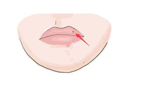 男人常见的旺妻痣婚后发达妻子沾光少奋斗十年