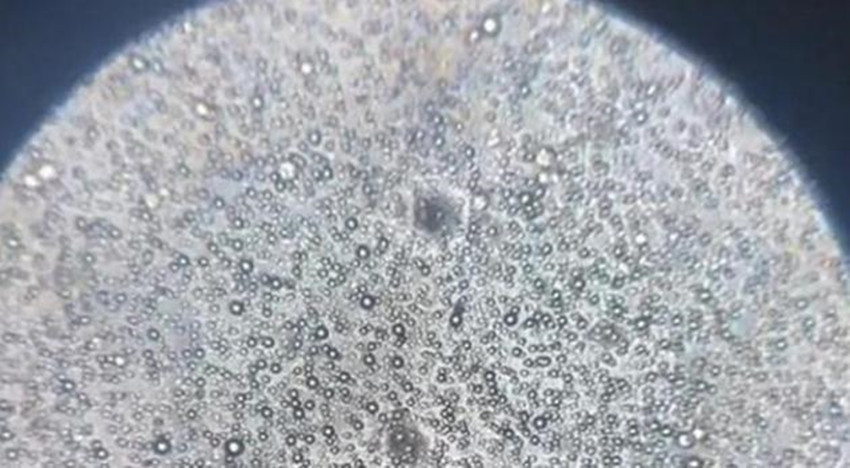 当母乳被放大1000倍后,在显微镜下轻轻蠕动,纯净得令人难以置信