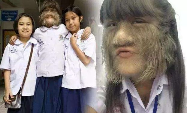 世界"体毛"最长的女性,曾打破世界纪录剔除毛发后,心动的感觉