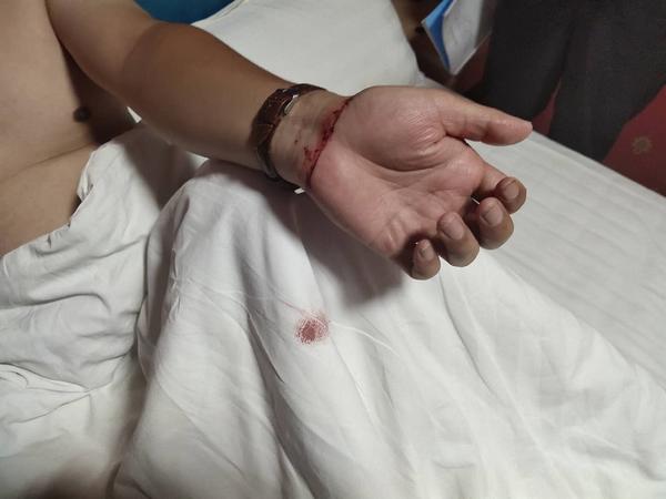 女友提出分手,男子在渑池一宾馆割腕自杀