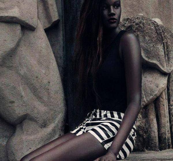 女孩黑的像碳一样,经常遭到嘲笑,最后却成为名模