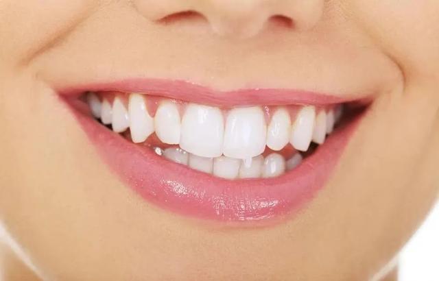 牙齿不齐,牙缝过宽
