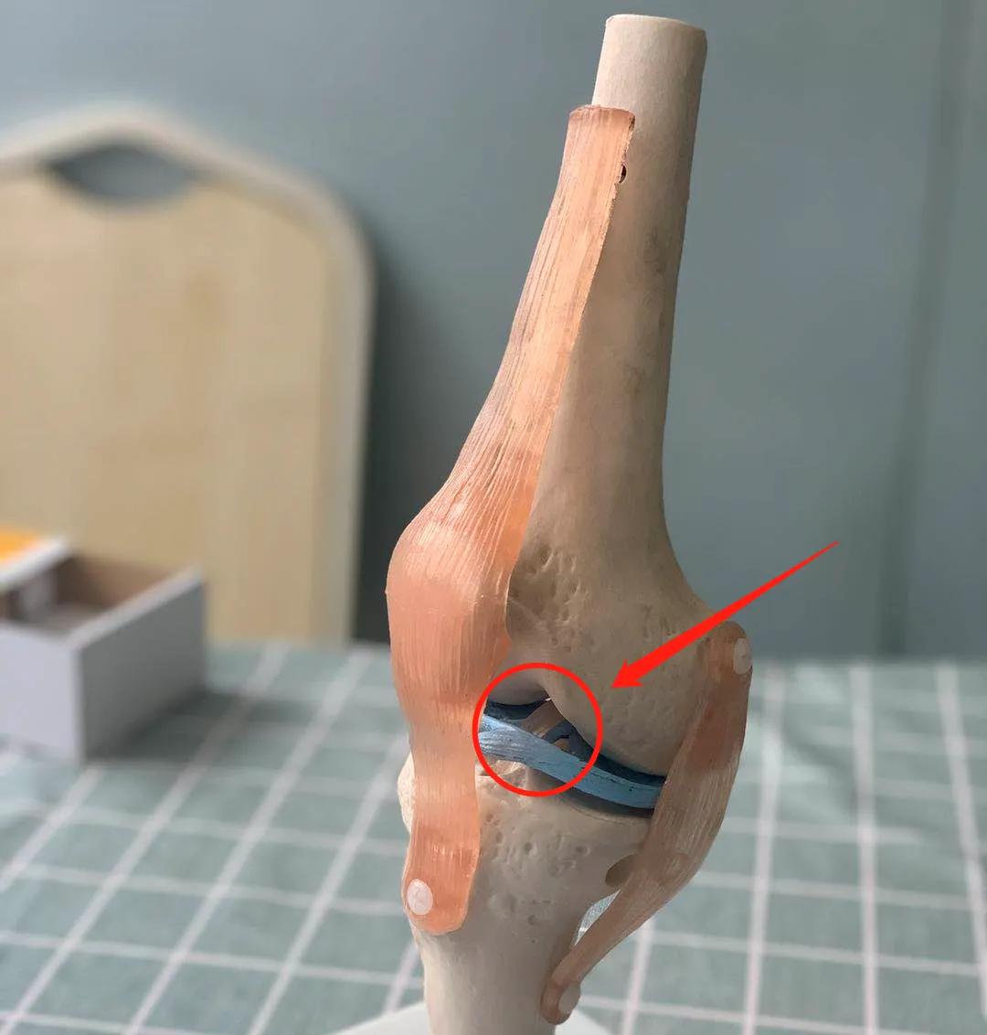 90后小伙一转身右腿韧带撕裂医生回不到从前状态