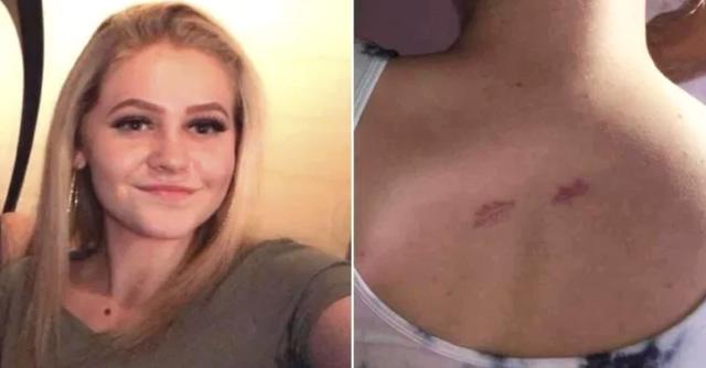 英少女因担心闺蜜抢走自己男朋友,竟真得捅了闺蜜两刀