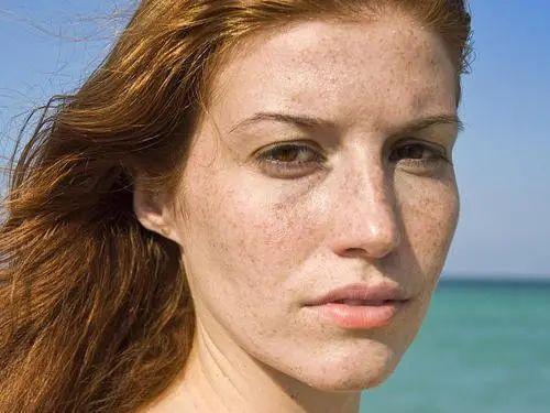 才20岁脸上就长斑了怎么解决