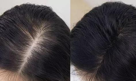 女性常披头发会导致发缝变宽、发量变少|头发|头皮|脱发_新浪新闻