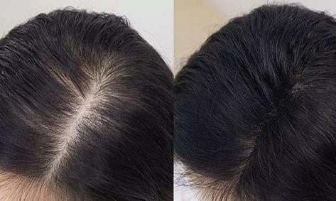 女性常披头发会导致发缝变宽、发量变少|头发|头皮|脱发_新浪新闻