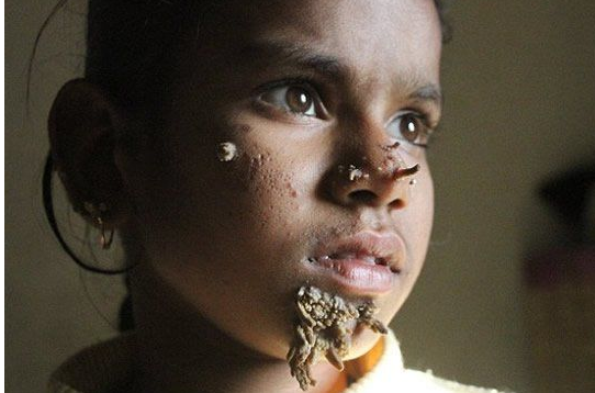 小女孩嘴角长满树枝,看后吓一跳,同学们却还愿意和她成为朋友|树人