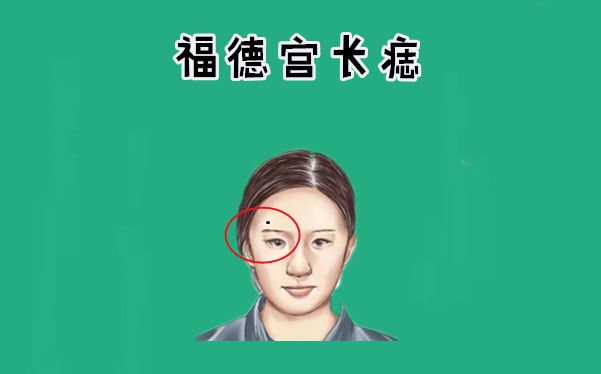 女人身上五颗恶痣留不得,破财耗财运,花光丈夫钱,拖累儿女!