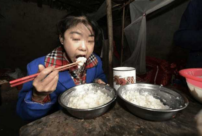 女孩每天只吃10斤米不吃菜,家里已没钱供养,医生检查却说没病