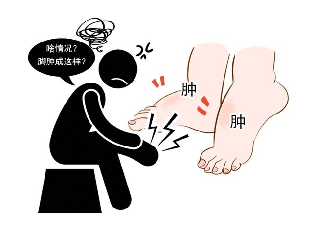 也要警惕这4个因素|水肿|浮肿|肾病_新浪新闻