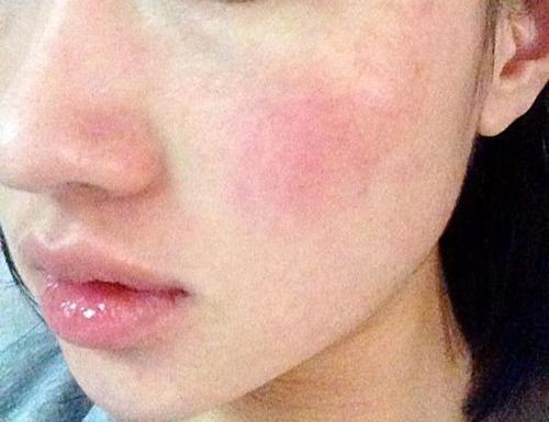 敏感肌必看!让你的脸红只留给心动