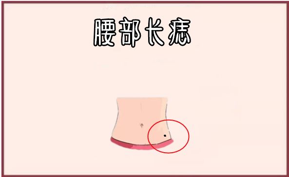 腰部长痣在相学当中,若是一个人的腰部的位置长有吉痣,大多数会有"