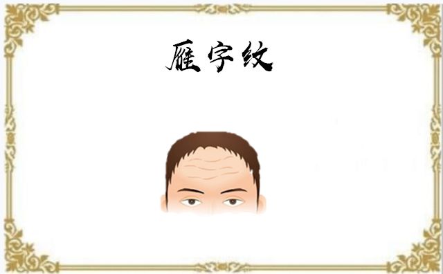 正文        所谓的雁字纹,就是指在额头上的乱纹与杂纹,而拥有此种