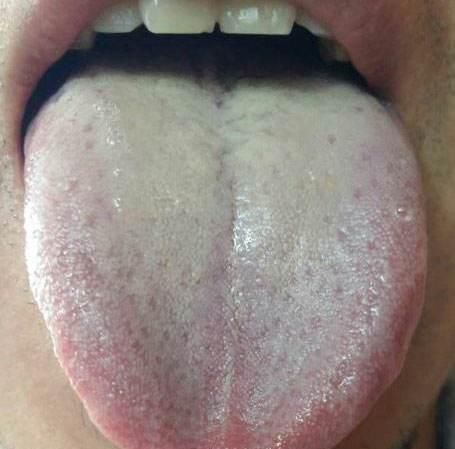 看舌苔:大家可以伸出舌头看一下自己的舌苔,如果舌苔厚重发白,说明体