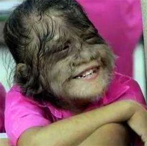 她是"体毛"最长的女性,曾打破吉尼斯纪录,剃掉毛后,美丽动人