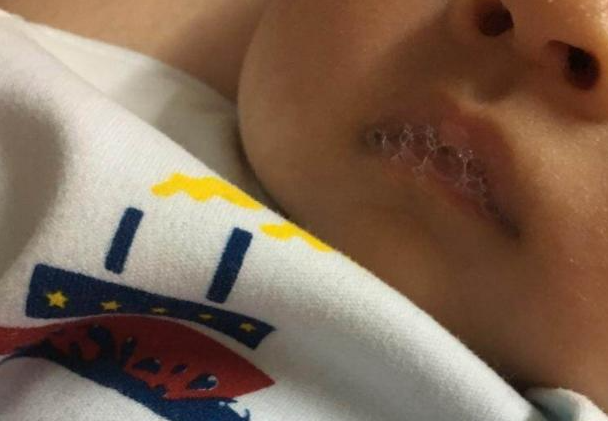 宝宝3个多月,嘴里总是吐泡泡,家长先别急,可能是这些原因