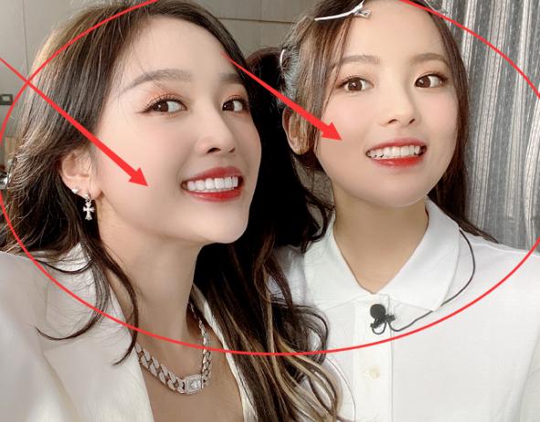 牙齿美白对女生多重要?吴宣仪杨超越龇牙合照,瞬间明白了