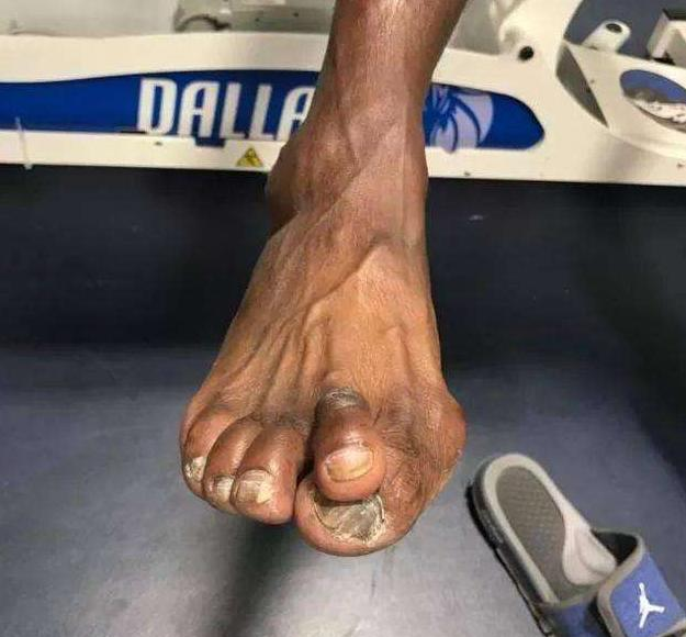 看了詹姆斯的脚,姚明的膝盖,科比的手,你还羡慕他们的高薪吗?