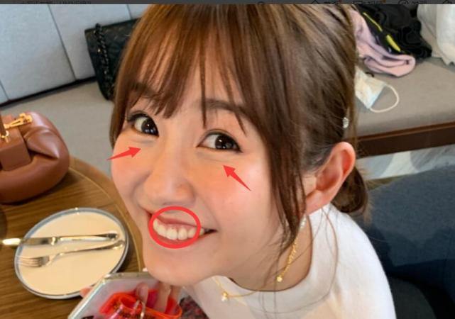 张子萱晒大头照,眼角皱纹明显少女感不再,被发现牙齿有菜很尴尬