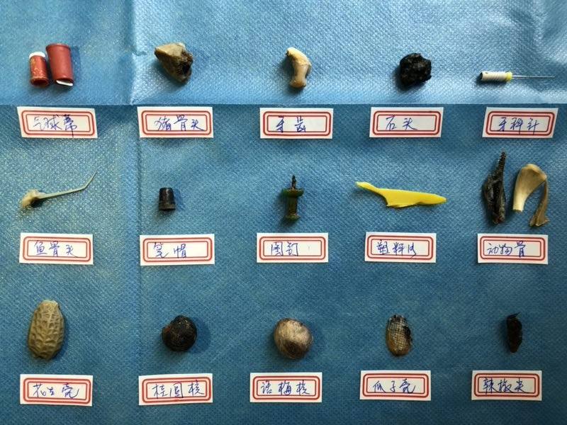 孩子好奇心强安全意识差,警惕细小物品的危险,家长要做好防范