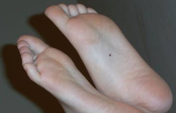 脚底就是聚宝盆拥有4种富贵脚一生大富大贵