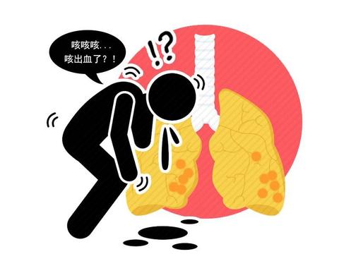 身体好不好,肩膀先知,肩膀反复出现这些疼痛,或是身体亮红灯了