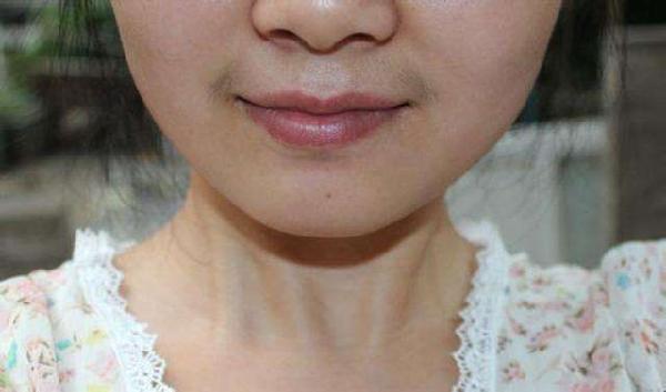 15岁女孩长出胡须,医生:这些食物不要再给孩子吃了,家长别心大