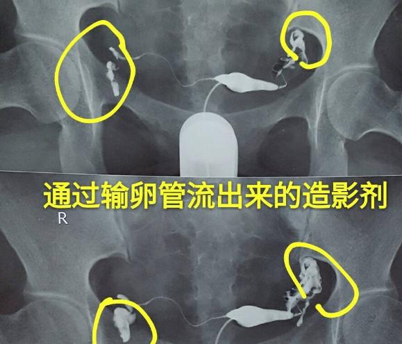 越来越多的女性不孕,究其原因不外乎是这些|卵巢|不孕|输卵管_新浪