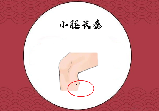 小腿长痣左小腿外侧长痣的人常年在外奔波,能够异地做成事业,或者女子