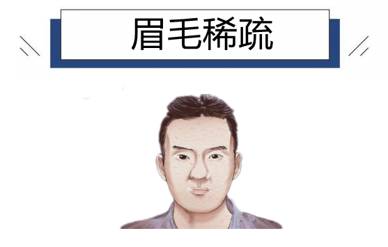 眉毛稀疏从眉毛长得好坏,可以看出一个人的脾气性格与财运等,若是眉毛
