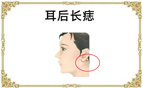 身上4颗富贵痣,命里藏财,天生金贵命,出生少奋斗十年!