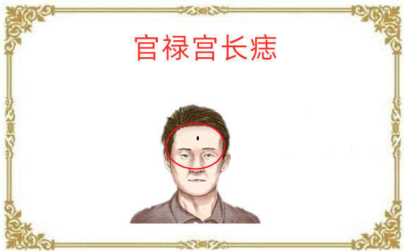 身体5颗"破财"痣,左手进财右手出,积蓄全无,打一辈子工!