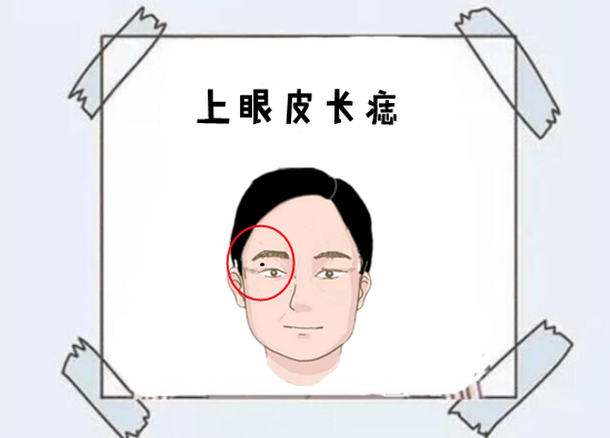 是非痣身体4颗小人痣为人不择手段坑穷别人富自己