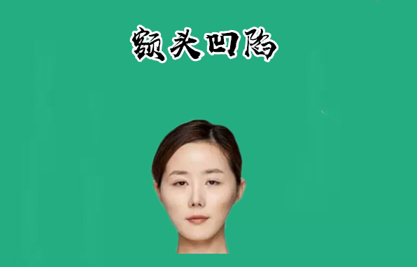 则一般的情况下,拥有此种面相的人,大多数少年运势不佳,自己本身也守