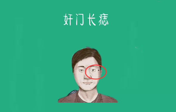 脸上5颗破财痣花钱大手大脚大钱没有小钱无晚年穷光蛋