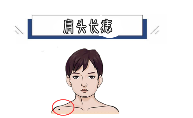 若是一个人的肩头的位置处长有恶痣,则此人的财库不丰,会频频漏财,没