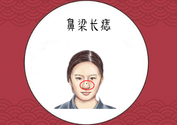 鼻梁长痣在相学当中,若是一个人的鼻梁处的位置长有恶痣,则通常的情况